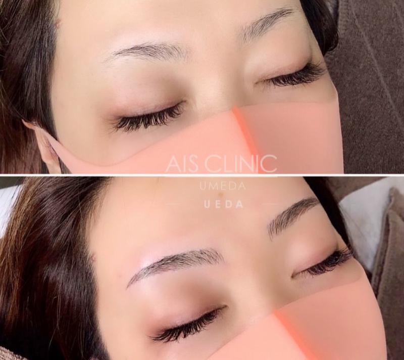 るいさんのホテル阪神大阪 テフのサ活写真