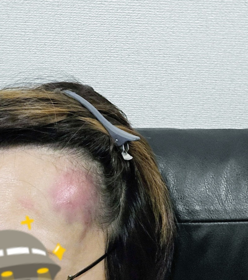 アキネクトさんのJRタワーホテル日航札幌 スカイリゾートスパプラウブランのサ活写真