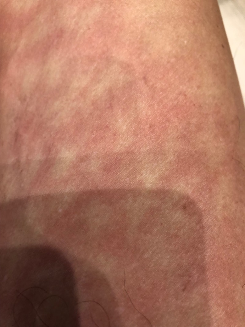 tacchy 魔都サッポロがスキすぎるさんのスポーツアカデミー ブランチ 札幌月寒のサ活写真