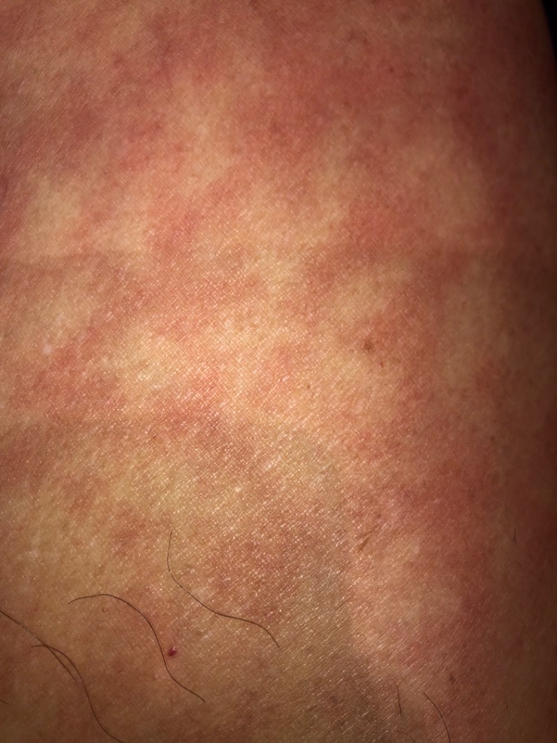 tacchy 魔都サッポロがスキすぎるさんのスポーツアカデミー ブランチ 札幌月寒のサ活写真